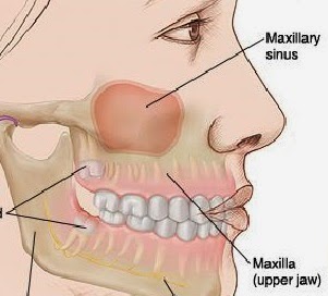Sinus pressure mouth pain